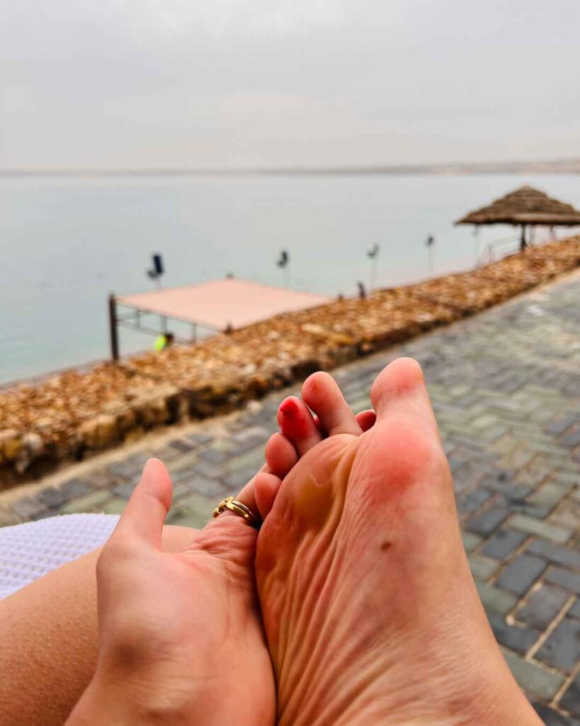 Dead Sea Marriott injury